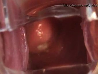 Avy Open Pussy with Speculum